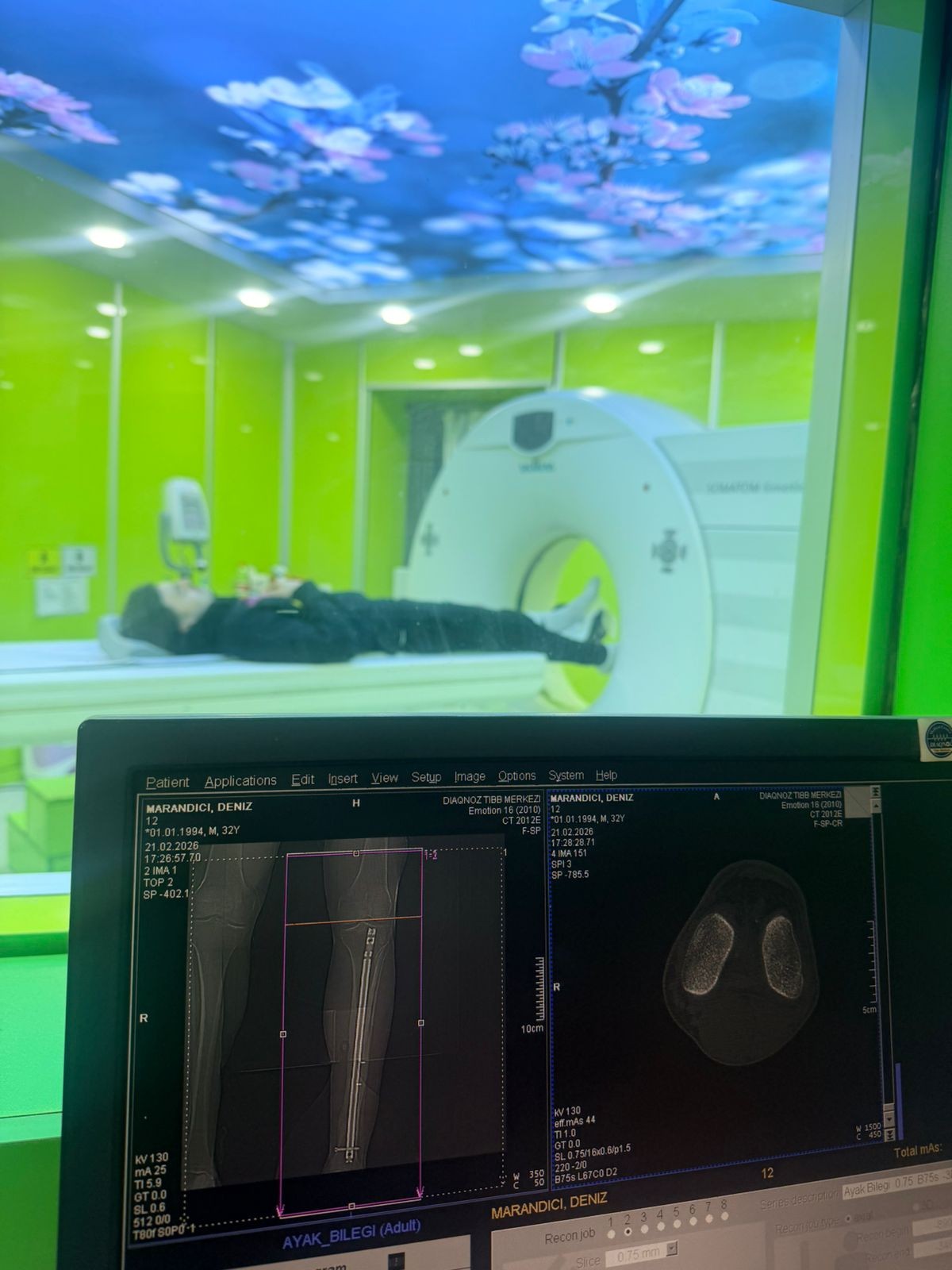 “Turan Tovuz” FK-nın futbolçusu Denis Marandiç Diaqnoz Tibb Mərkəzində müayinələrdən keçib! 